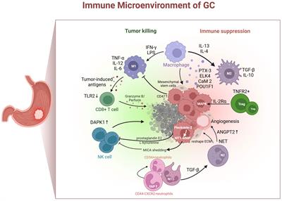 Research progress on the immune microenvironment and immunotherapy in gastric cancer